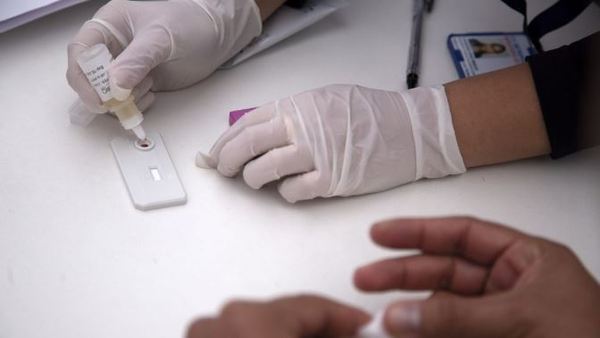 Hallan una segunda mutación genética resistente al virus del sida - .::RADIO NACIONAL::.