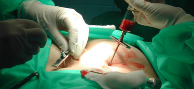 HOY / Paraguay contará con registro de donantes de médula e ingresará en un listado mundial