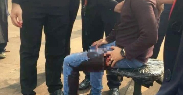 Joven rapai sobrevivió a un atentado