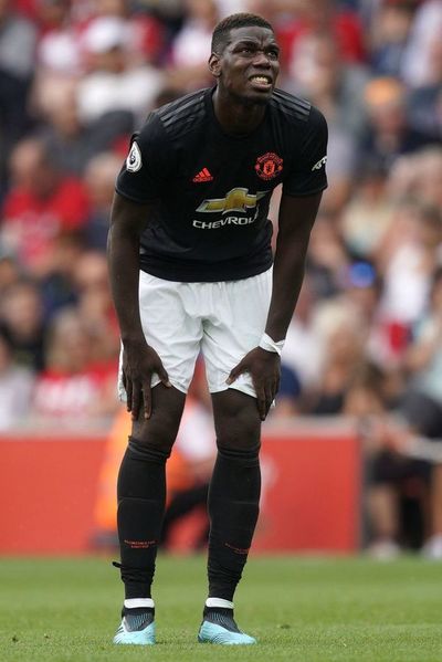 Pogba, baja en Francia - Fútbol - ABC Color