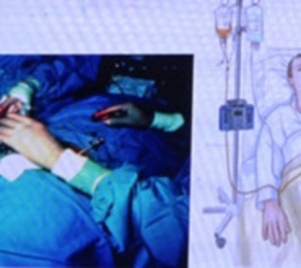 Paraguay ingresa a red mundial de donantes de médula ósea - Paraguay.com