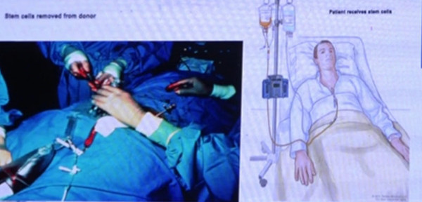 Paraguay es parte de la comunidad internacional de donantes de médula ósea | Noticias Paraguay
