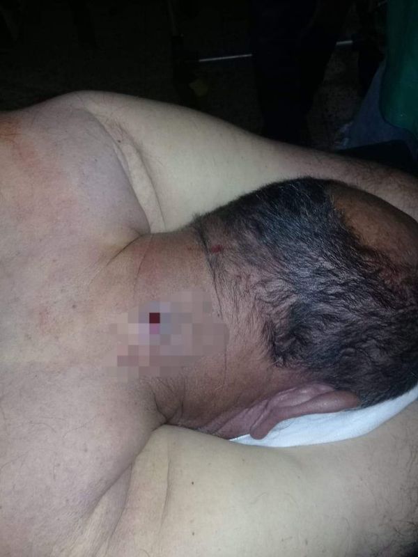 Asesinan a comisario retirado en Fassardi - Nacionales - ABC Color