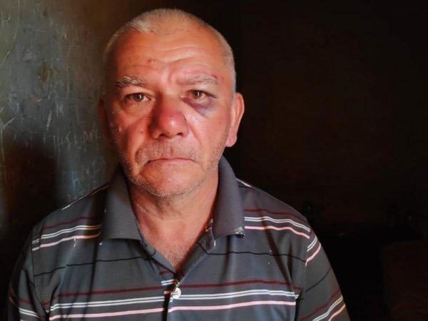 Acusó a su suegro de quemar su coche