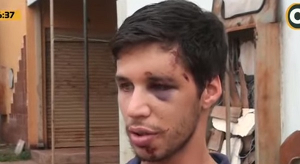 Joven pide justicia tras ser víctima de golpes con amortiguador de moto