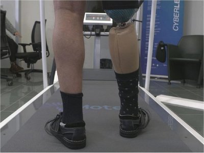 Una pierna artificial ayuda a sentir su uso