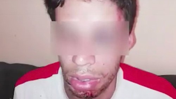 Su socio lo dejó como “carne para milanesa”