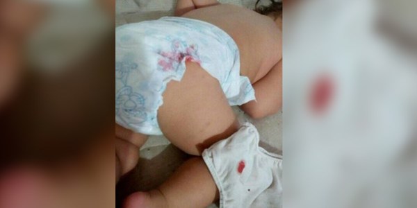 VACUNARON A UN BEBÉ CON JERINGA PARA ADULTOS
