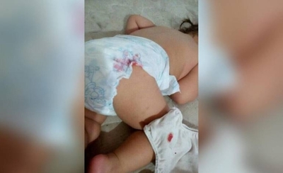 HOY / Bebé llegó con fiebre a IPS, le aplicaron inyectable para adulto y terminó con la pierna inmóvil