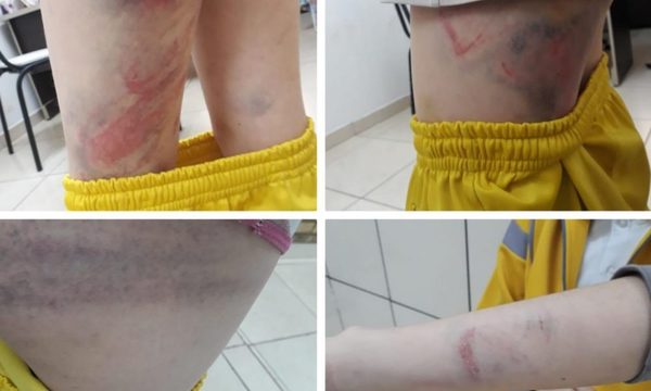 Niña fue brutalmente golpeada por sus padres