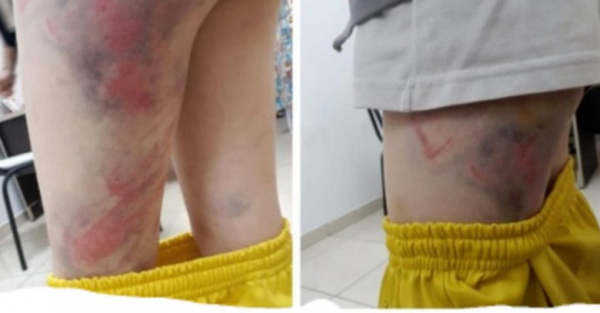 Denuncian a papis por dar de cintarazos a su retoñita