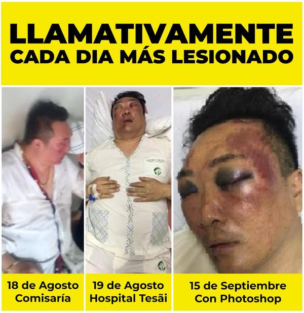 Martin Choi manipula historial médico para seguir evadiendo proceso penal