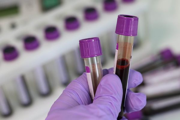 Madre denuncia que su hijo con cáncer se infectó con VIH en hospital público - Nacionales - ABC Color