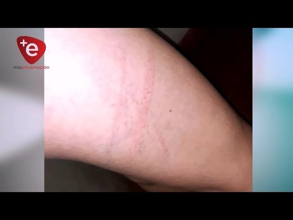 RESCATAN A MENOR POR SUP. MALTRATOS