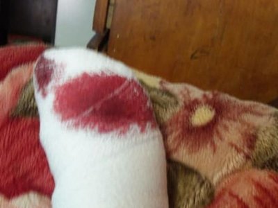 Tres perros casi dejan sin dedo a una profe