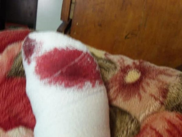 Tres perros casi dejan sin dedo a una profe