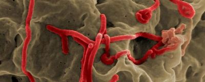Japón importa muestras de ébola y otros virus mortales con fines científicos - Ciencia - ABC Color