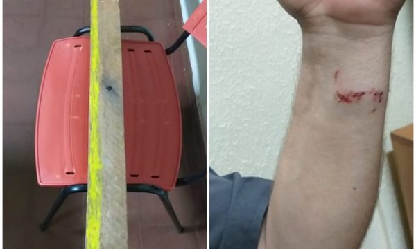 Conductor agrede a agente de la Patrulla Caminera