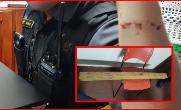 Agente de la Caminera es agredido con un trozo de madera