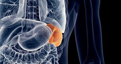 Enfermedad de Gaucher: concienciar para sobrevivir » Ñanduti