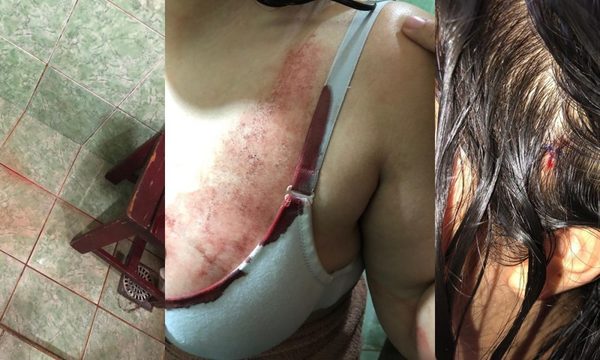 Estudiante fue brutalmente agredida a martillazos