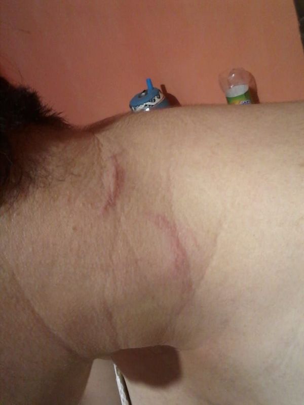 Denuncian violencia intrafamiliar en Carmelo Peralta - Nacionales - ABC Color