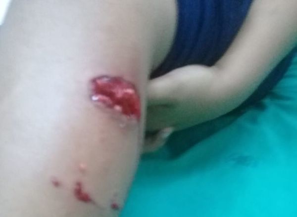 Pitbull muerde a alumnos de un colegio - Judiciales y Policiales - ABC Color