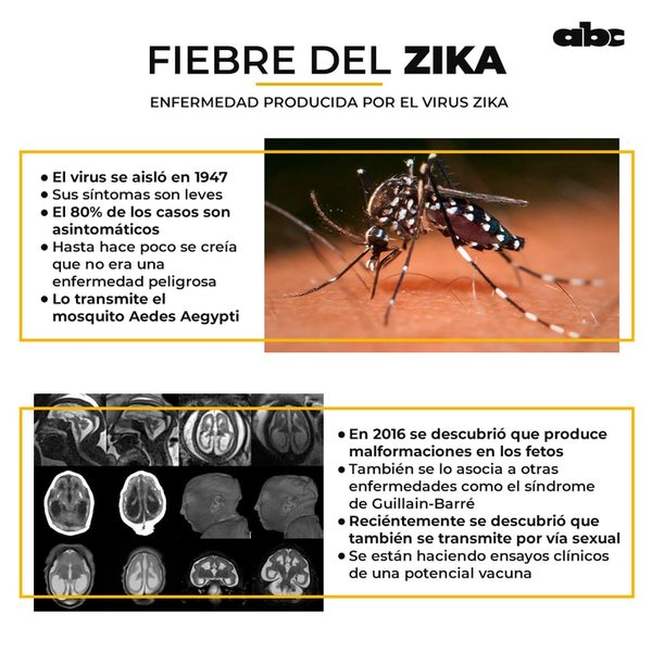 El zika, un virus infravalorado - Notas - ABC Color
