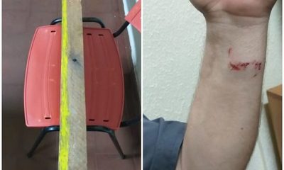 Piden rebeldía de camionero que atropelló y agredió a agente de la Caminera durante control