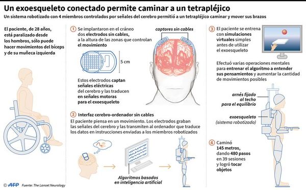 Exoesqueleto ayuda a tetrapléjico a caminar - Internacionales - ABC Color