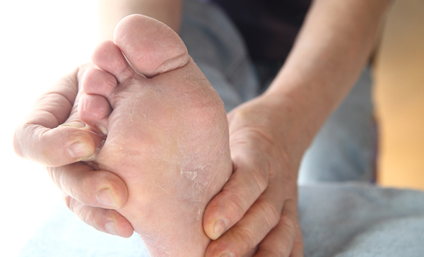 Hongos en los pies, principales consultas en Podología del Hospital de Clínicas » Ñanduti