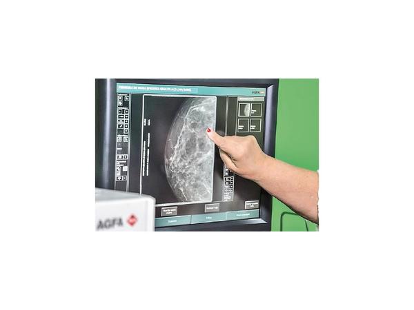 Clínica para mujeres recibe donación de mamógrafo digital