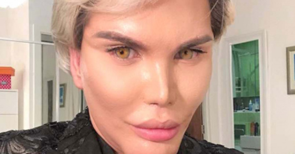 Ken rapai puede perder toda la nariz