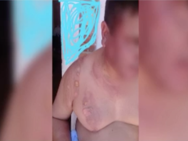 HOY / VIDEO | Pasajero tira agua caliente a chofer de bus