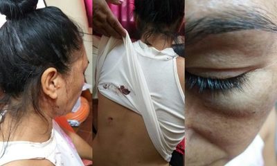 Joven agredió brutalmente a su madre