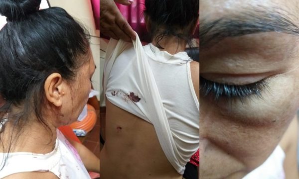 Joven agredió brutalmente a su madre