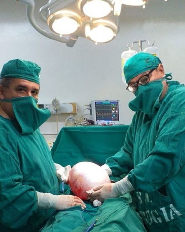 Extirpar un tumor de 6 kilos en Cnel Oviedo