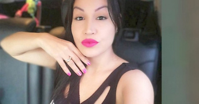Ex modelo denuncia que spa le dejó la pierna shalái | Crónica