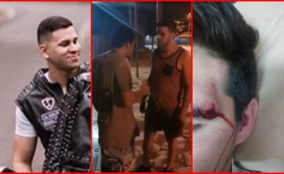 Joven es brutalmente agredido en Pdte. Franco