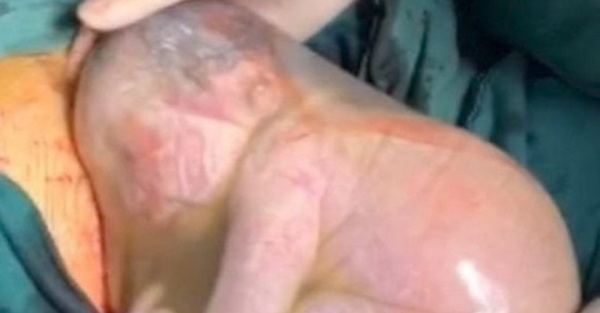 Bebé chino salió apurado de la panza materna | Crónica