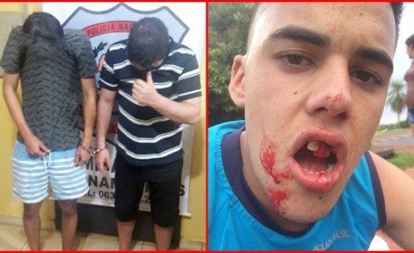 Adolescente ciclista fue agredido brutalmente por ebrios al volante