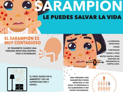 Sarampión: Paraguay en alerta ante aumento de casos en la región