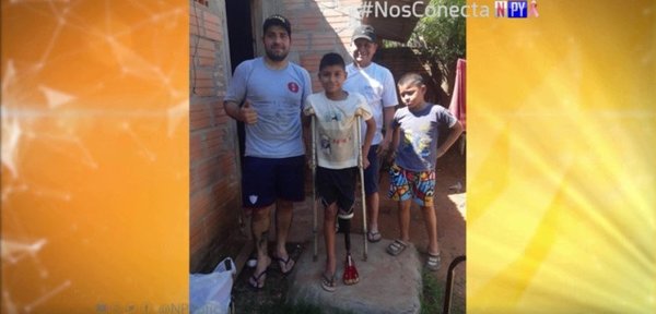 Fabrican prótesis para niño de escasos recursos | Noticias Paraguay
