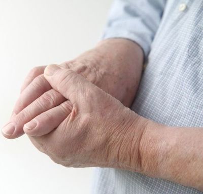 Artritis, la enfermedad reumática más común - Nacionales - ABC Color