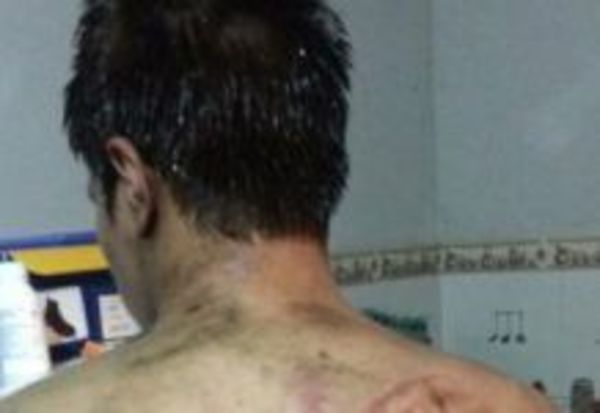 Imputan a alumnos que organizaron violento bautismo en Veterinaria