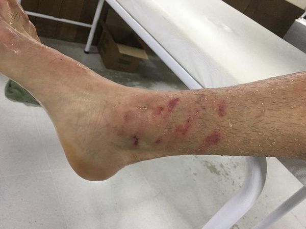Terrible: así quedó la pierna de Gómez - Fútbol - ABC Color
