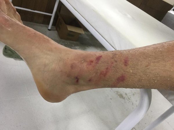 Terrible patada al Espartano Gómez
