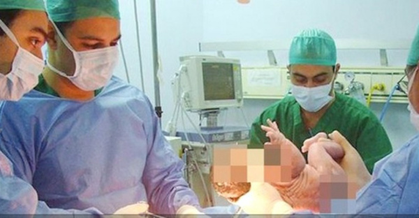 Médicos shockeados: nació bebe sin pene