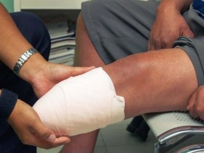 Le amputaron la pierna a supuesto motochorro y su mamá culpa a policía