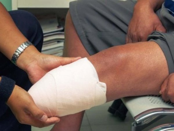 Le amputaron la pierna a supuesto motochorro y su mamá culpa a policía